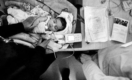 Le foto di Giles Duley all'Emergency Infopoint di Torino. Identificazione di una ferita.